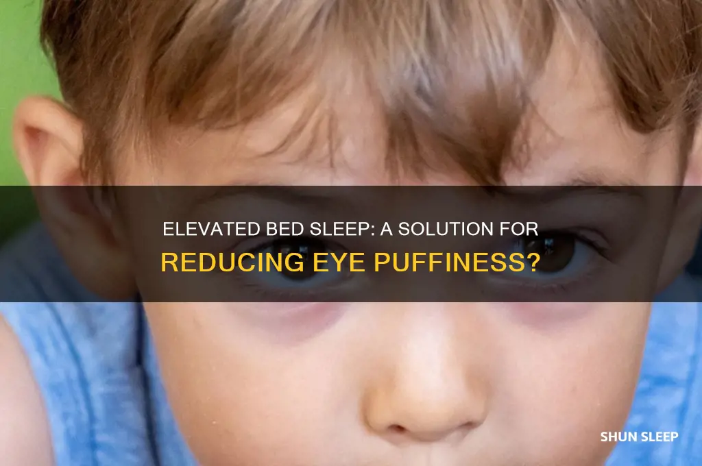 does sleeping on an elevated bed help eye puffiness