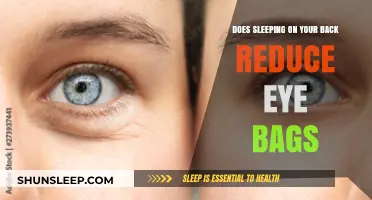 Back Sleeping: A Solution to Eye Bags?