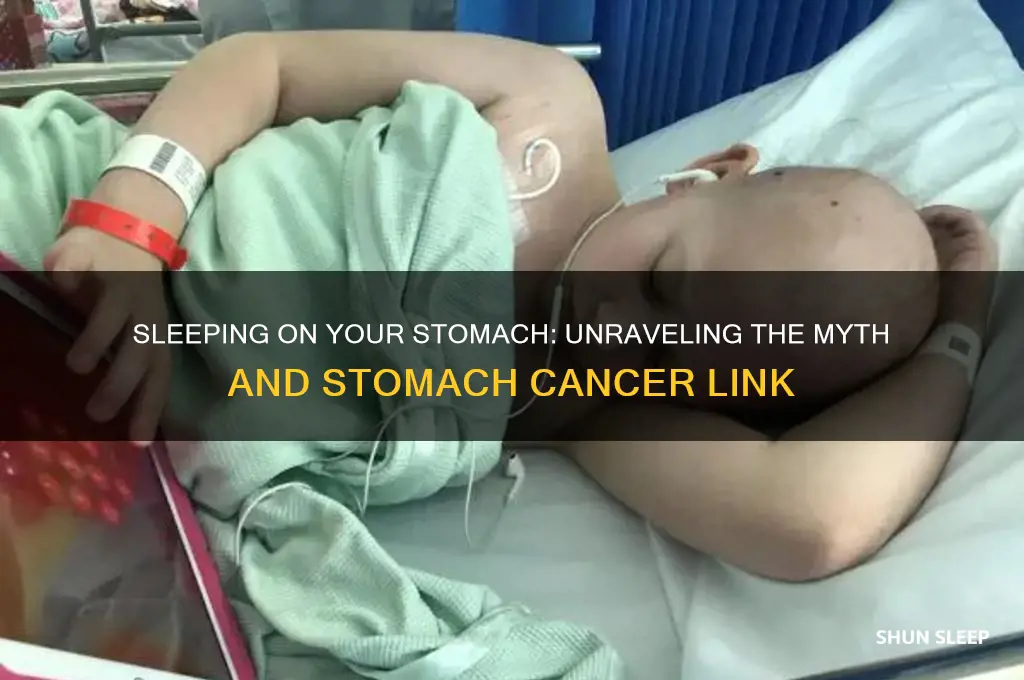 does sleeping on your stomach help stomach cancer