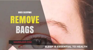 How Sleep Helps Reduce Under-Eye Bags