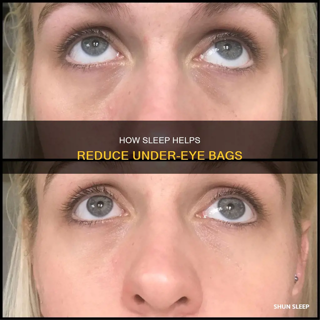 does sleeping remove bags