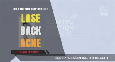 Sleeping Shirtless: A Simple Hack to Combat Back Acne?