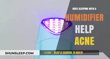 Can a Humidifier Improve Your Skin and Reduce Acne?