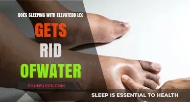 Elevated Legs for Water Retention: Myth or Effective Sleep Solution?