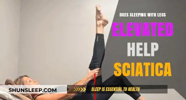 Elevated Legs for Sciatica Relief: Does It Really Work?