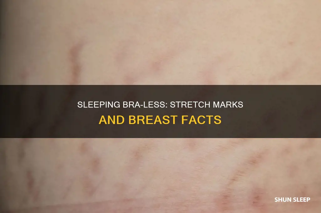 does sleeping without a bra give you stretch marks