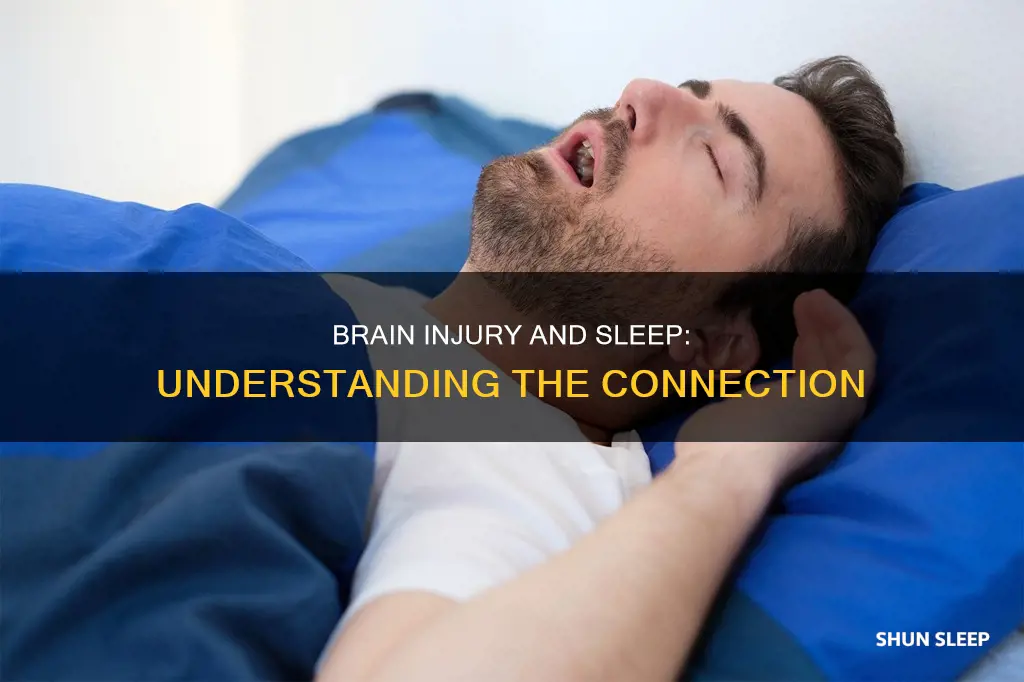 does someone with a tbi need more sleep than others