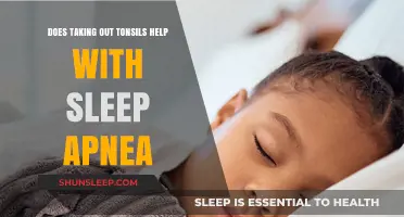 Tonsillectomy and Sleep Apnea: Can Removing Tonsils Improve Breathing?
