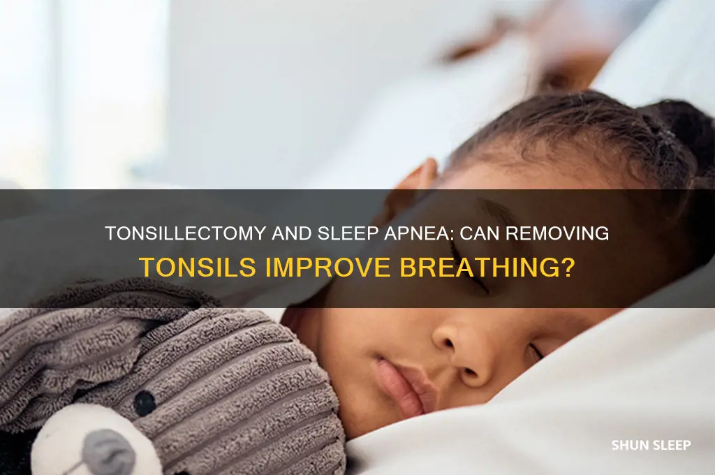 does taking out tonsils help with sleep apnea