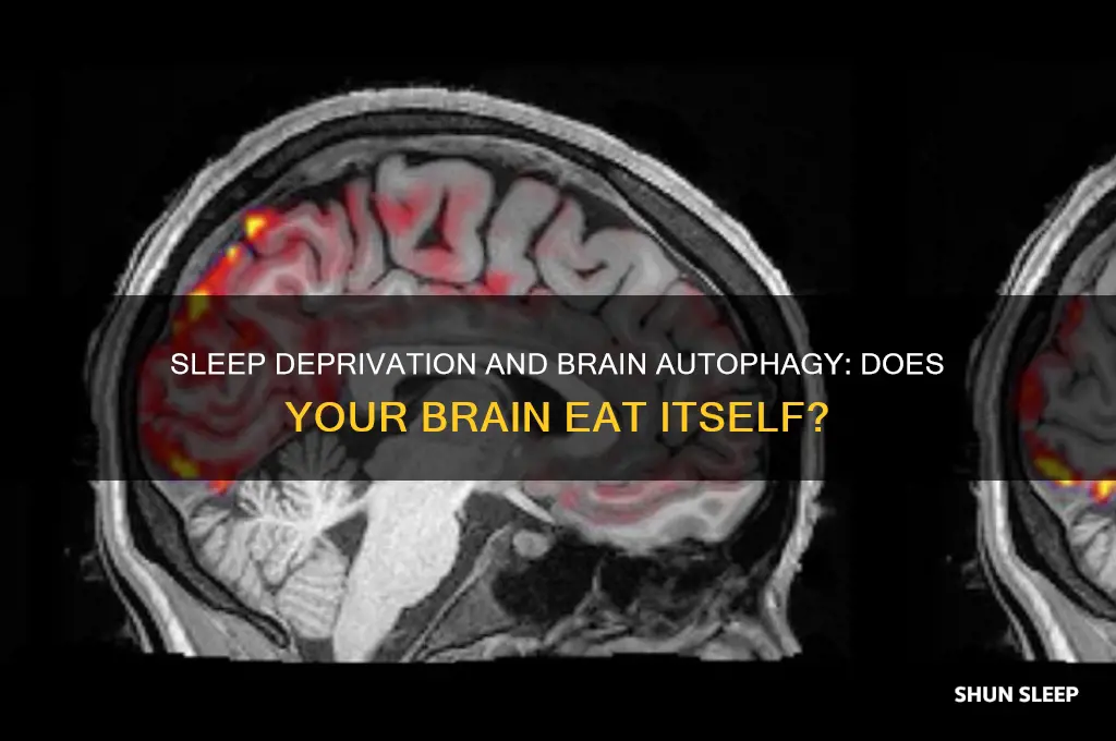 does the brain eat itself when not getting enough sleep