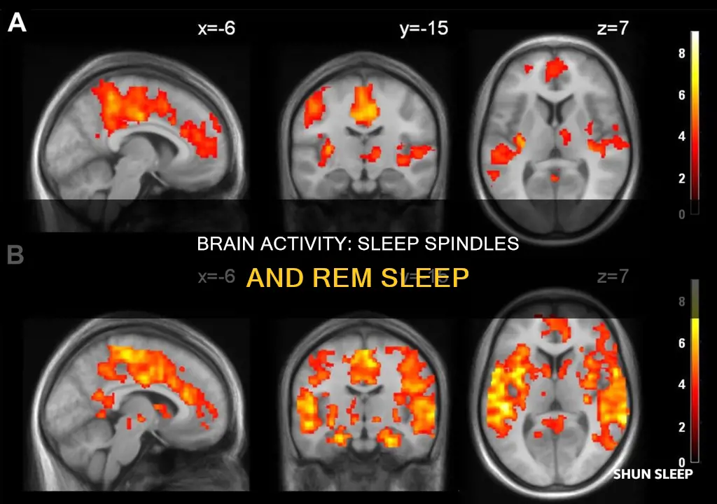 does the brain produce sleep spindles during rem sleep