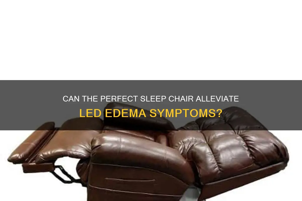 does the perfect sleep chair help led edema