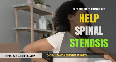 Sleep Number Bed: Spinal Stenosis Relief or Just Hype?