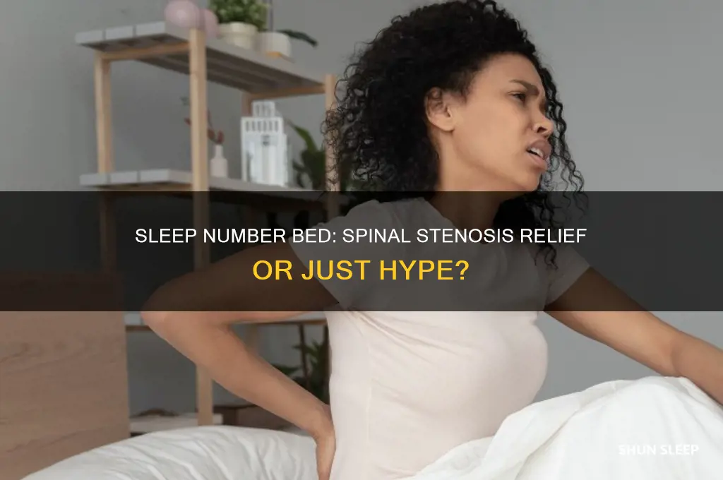does the sleep number bed help spinal stenosis