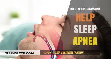 Turbinate Reduction for Sleep Apnea: Effective Treatment or Myth?