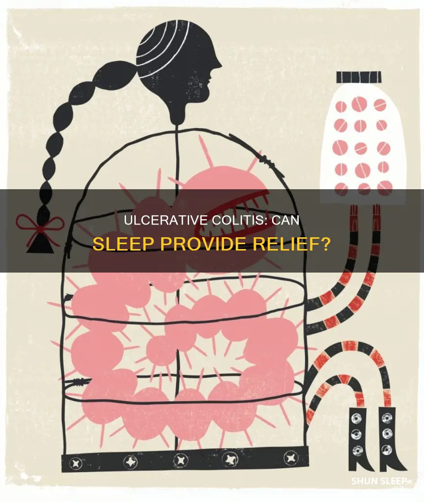 does ulcerative colitis feel better after sleeping