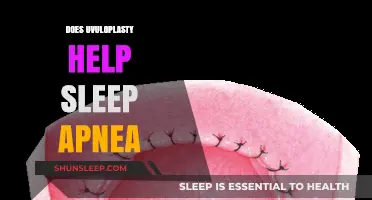Uvuloplasty for Sleep Apnea: Effective Treatment or Temporary Relief?