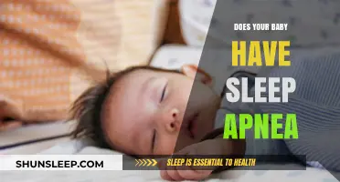 Is Your Baby's Sleep Disrupted? Understanding Infant Sleep Apnea Symptoms