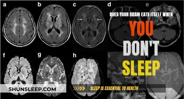 Brain Self-Cannibalism: The Dark Side of Sleep Deprivation