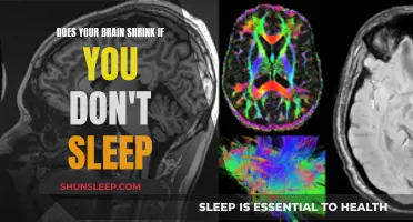 Brain Shrinkage: The Impact of Sleep Deprivation