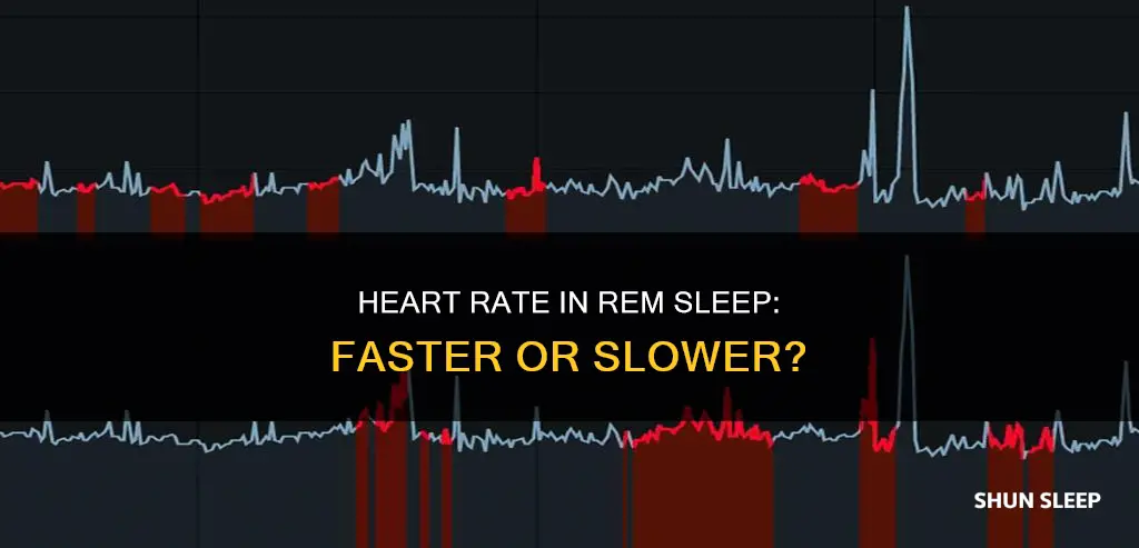 does your heart beat faster in rem sleep