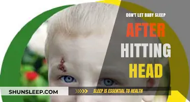 Head Injury Alert: Why Babies Shouldn't Sleep After a Bump