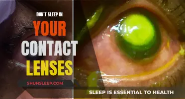 Sleeping with contacts: A dangerous habit to avoid