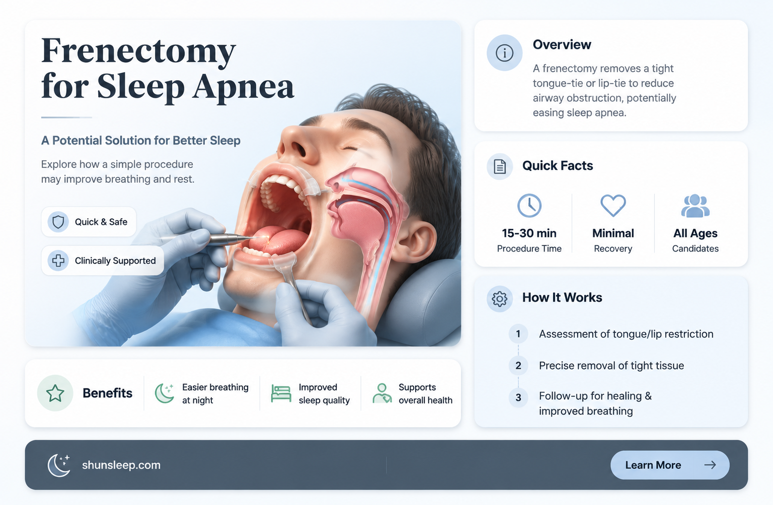 can a frenectomy help sleep apnea