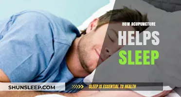 Acupuncture for Better Sleep: Natural Relief for Insomnia and Restlessness