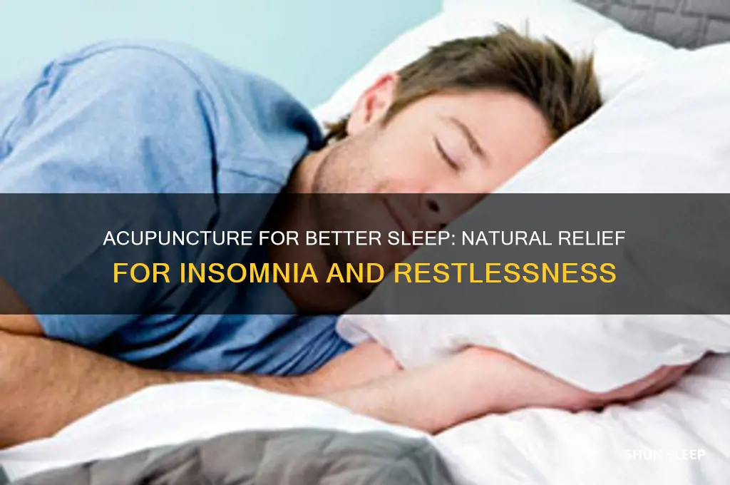 how acupuncture helps sleep