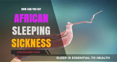 Understanding African Sleeping Sickness: Causes, Transmission, and Prevention Tips