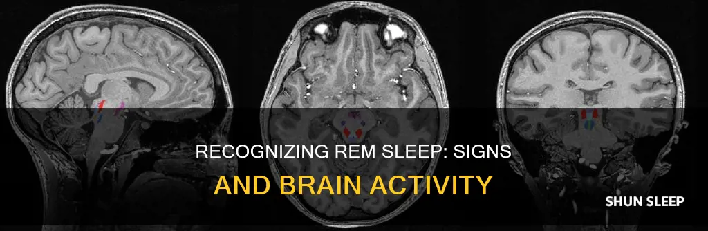 how can you tell if someone is in rem sleep