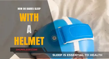 Helmet Sleep Tips: Helping Babies Rest Comfortably with Cranial Remolding