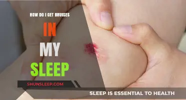 Why Do I Wake Up with Bruises? Causes and Prevention Tips