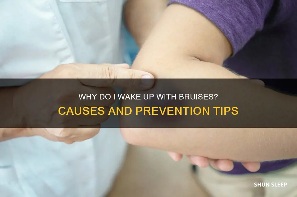 how do i get bruises in my sleep