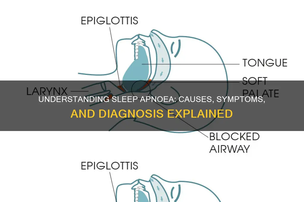 how do i get sleep apnoea