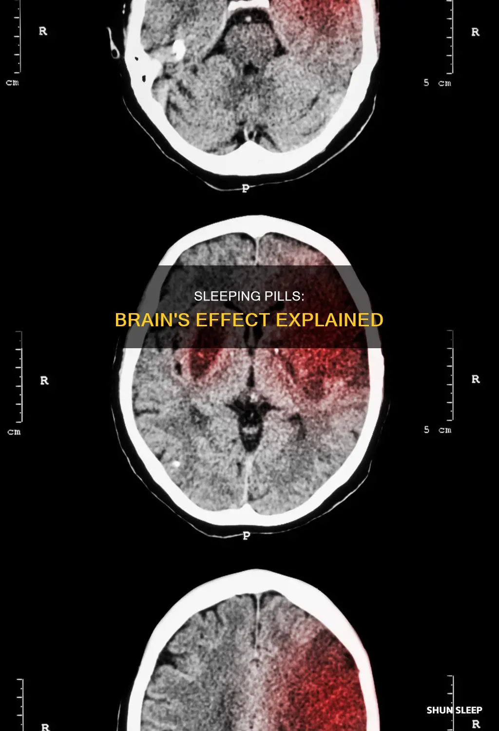 how do sleeping pills work in the brain