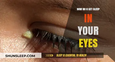 Understanding Sleep in Your Eyes: Causes, Prevention, and Quick Remedies