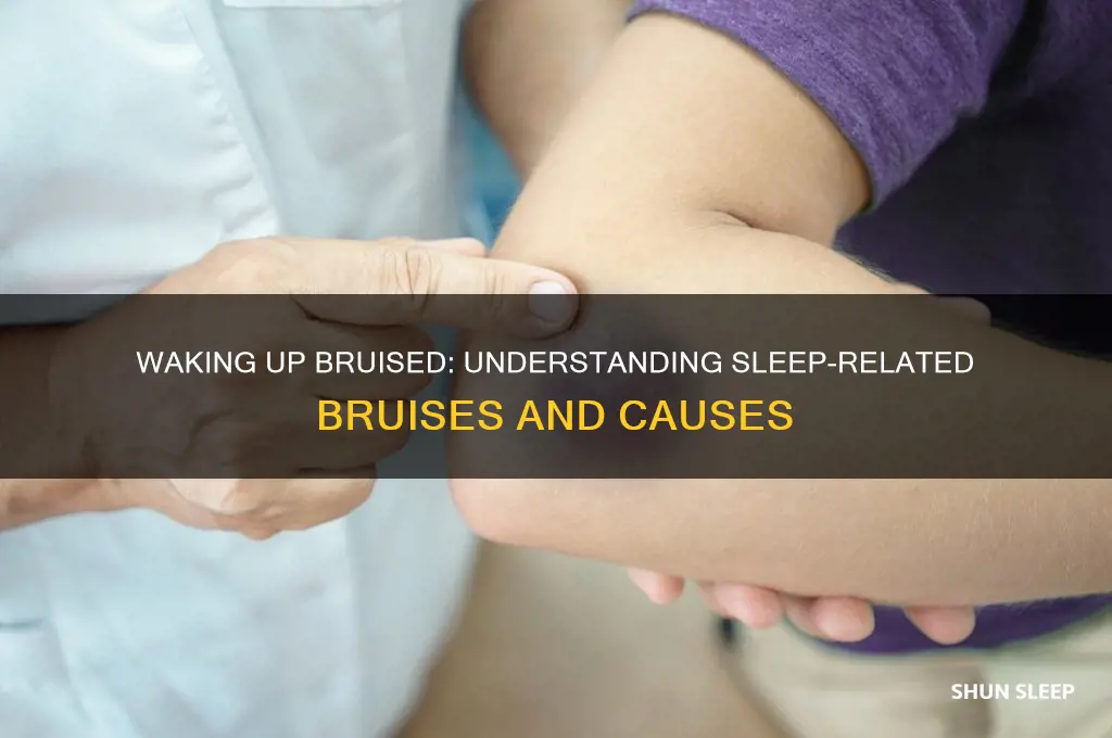 how do you get bruses in your sleep