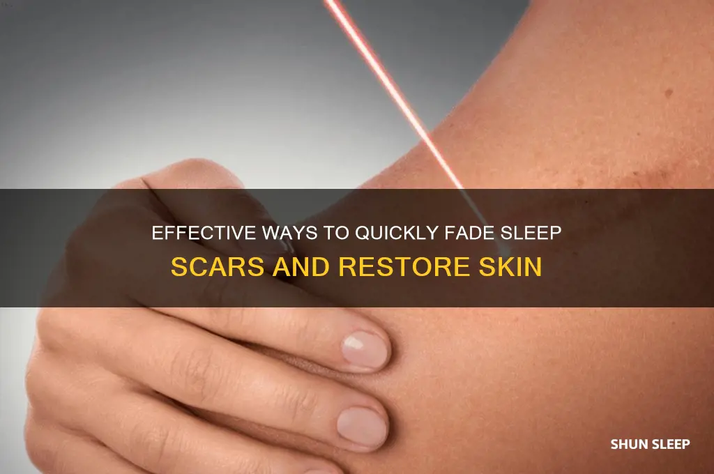 how do you get rid of sleep scars quick