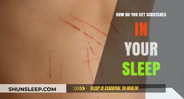 Waking Up with Scratches: Understanding Sleep-Related Skin Marks