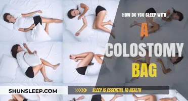 Living with a Colostomy Bag: Sleeping Peacefully