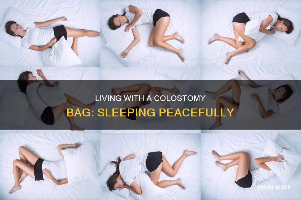 how do you sleep with a colostomy bag