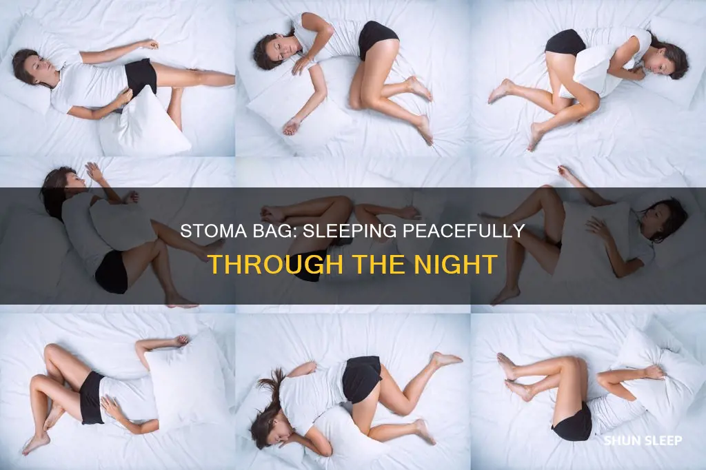 how do you sleep with a stoma bag