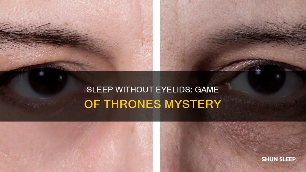 how do you sleep without eyelids game of thrones