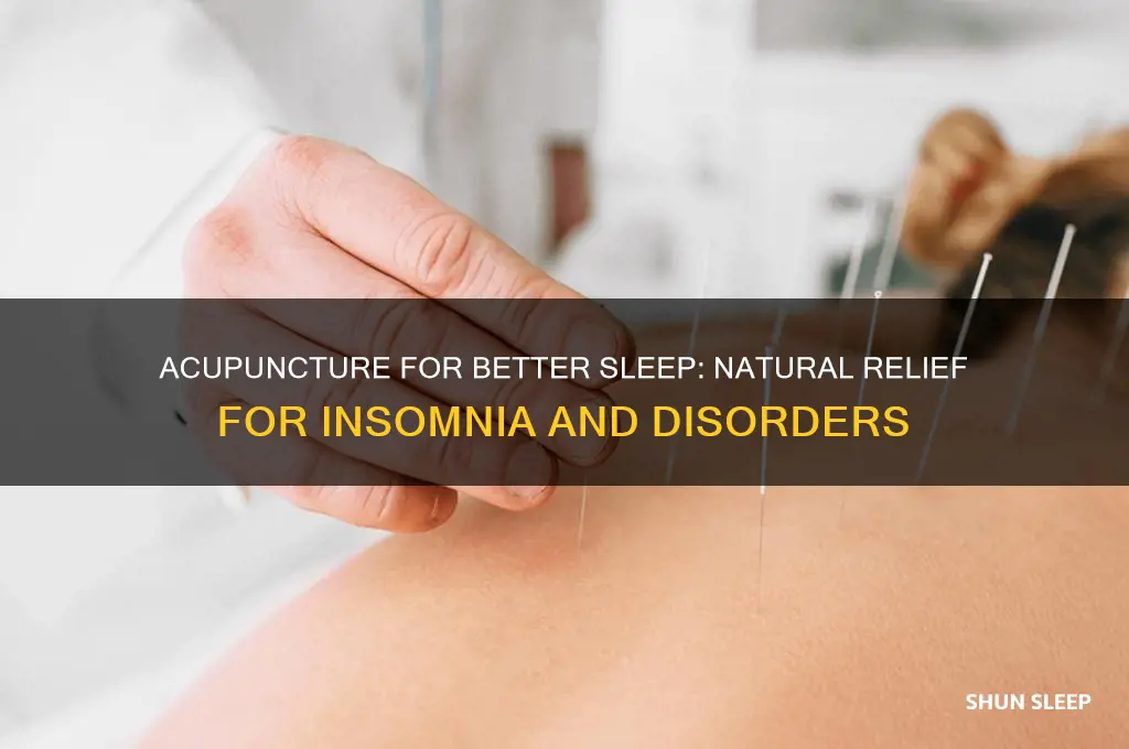 how does acupuncture help sleep disorders
