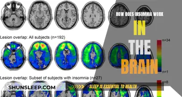 Brain Insomnia: Understanding the Science Behind Sleeplessness