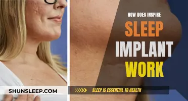 Inspire Sleep Implant: How Does It Work?