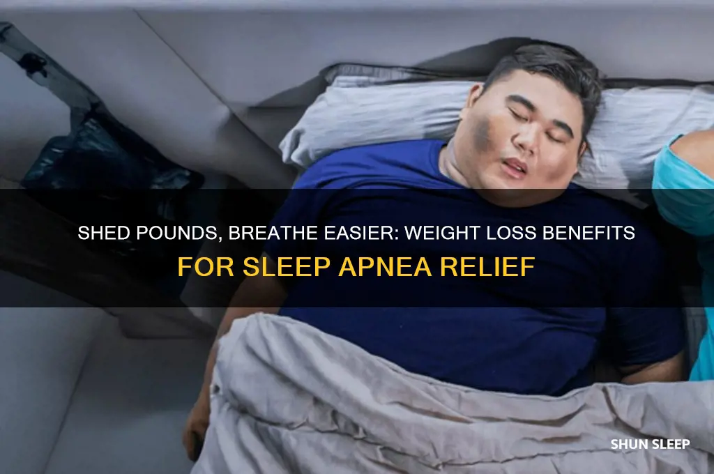 how does losing weight help sleep apnea