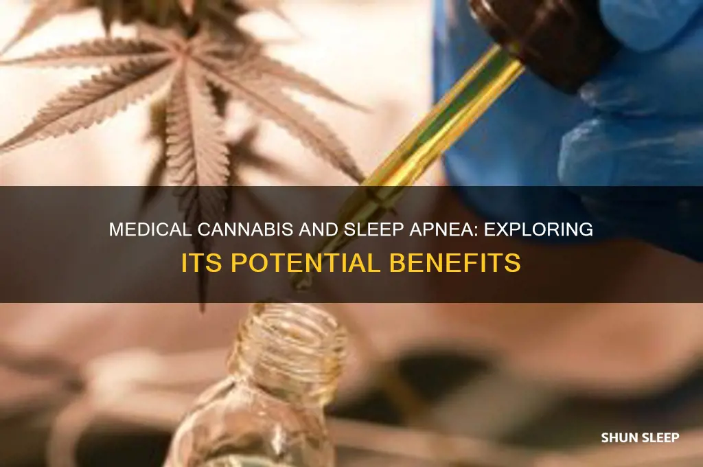 how does medical cabbannis help sleep apnea